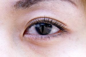 大阪でのタトゥー除去を徹底比較！信頼できるクリニック選びと施術方法ガイド